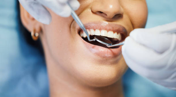 Best Pediatric Emergency Dentist in Hillsborough, CA